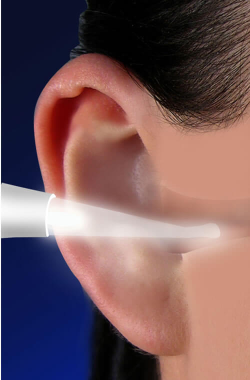 Lighted Ear Wax Remover